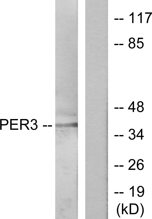 WB analysis of Jurkat cells treated with insulin 0.01U/ml (15mins) lysate using GTX87243 PER3 antibody. The lane on the right is blocked with the synthesized peptide. WB analysis of Jurkat cells treated with insulin 0.01U/ml (15mins) lysate using GTX87243 PER3 antibody. The lane on the right is blocked with the synthesized peptide.