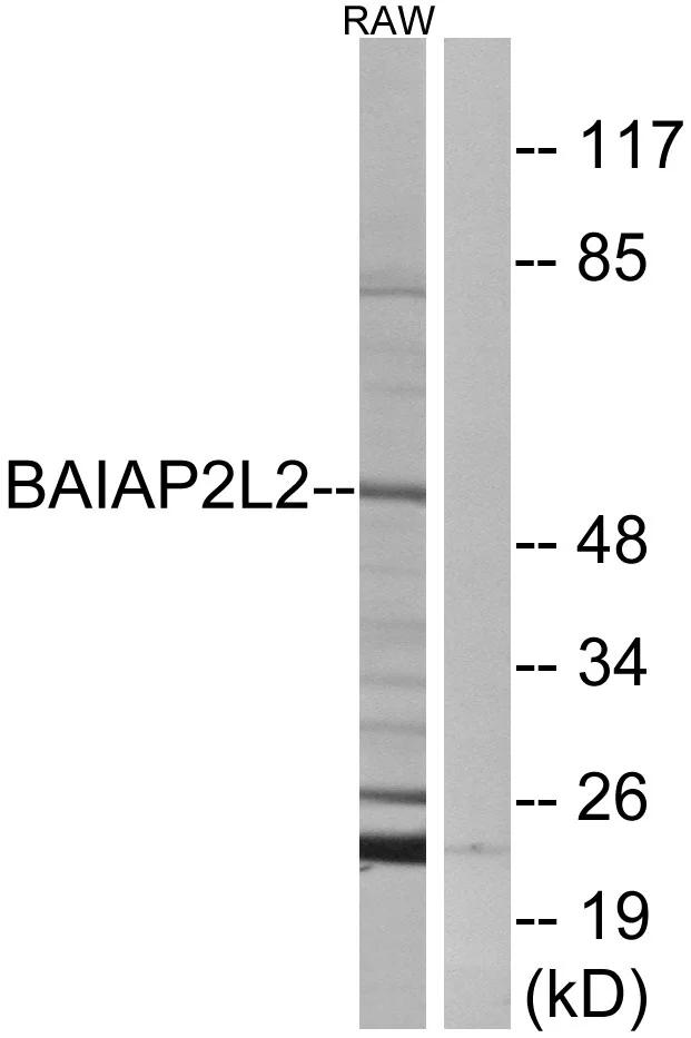 WB analysis of RAW264.7 cell lysates using GTX87252 BAIAP2L2 antibody. The lane on the right is blocked with the synthesized peptide. WB analysis of RAW264.7 cell lysates using GTX87252 BAIAP2L2 antibody. The lane on the right is blocked with the synthesized peptide.