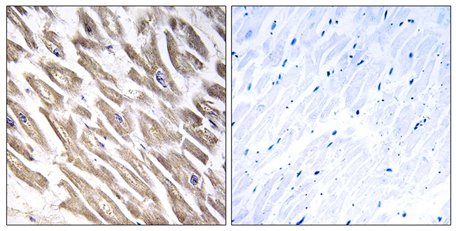 IHC-P analysis of human heart tissue using GTX87291 F13B antibody. The picture on the right is blocked with the synthesized peptide.