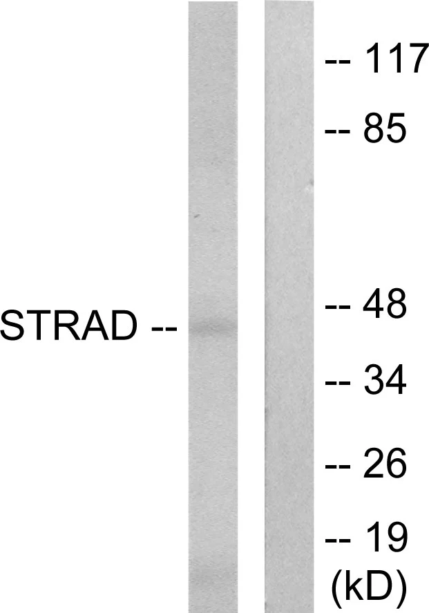 WB analysis of HepG2 cell lysates using GTX87312 LYK5 antibody. The lane on the right is blocked with the synthesized peptide. WB analysis of HepG2 cell lysates using GTX87312 LYK5 antibody. The lane on the right is blocked with the synthesized peptide.