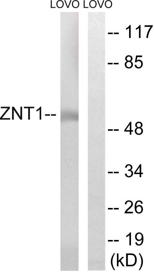 WB analysis of LOVO cell lysates using GTX87313 SLC30A1 antibody. The lane on the right is blocked with the synthesized peptide. WB analysis of LOVO cell lysates using GTX87313 SLC30A1 antibody. The lane on the right is blocked with the synthesized peptide.