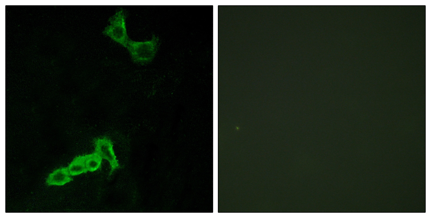 ICC/IF analysis of MCF7 cells using GTX87323 GPR137C antibody. The picture on the right is blocked with the synthesized peptide. ICC/IF analysis of MCF7 cells using GTX87323 GPR137C antibody. The picture on the right is blocked with the synthesized peptide.