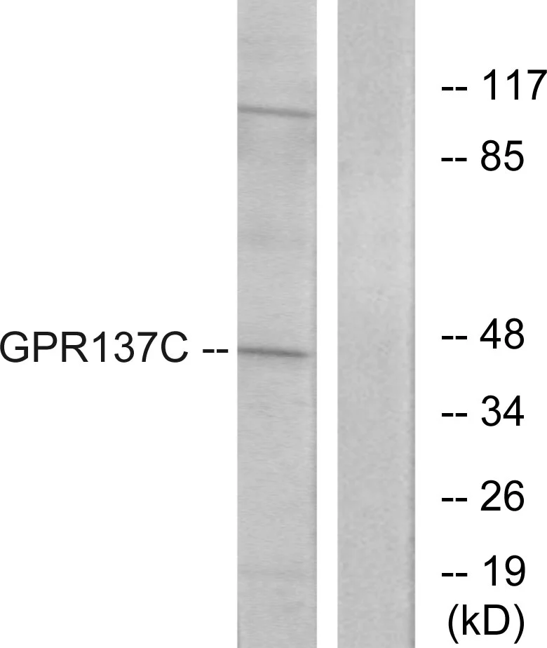 WB analysis of HepG2 cell lysates using GTX87323 GPR137C antibody. The lane on the right is blocked with the synthesized peptide.
