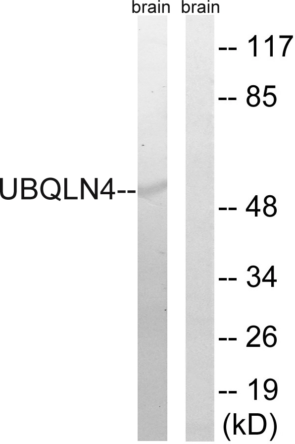 WB analysis of mouse brain tissue lysates using GTX87325 Ubiquilin 4 antibody. The lane on the right is blocked with the synthesized peptide.