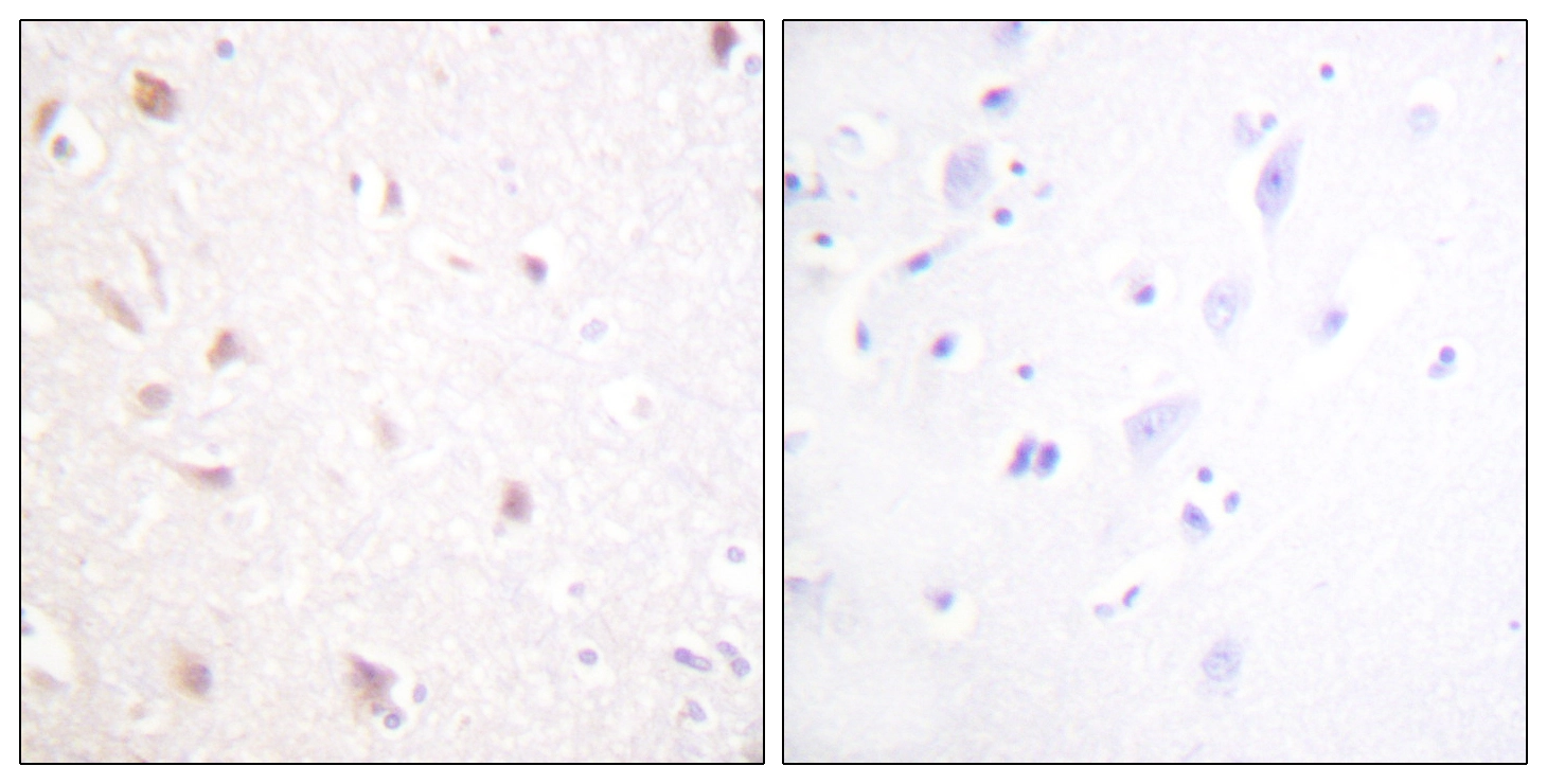 IHC-P analysis of human brain tissue using GTX87326 NIFK antibody. The picture on the right is blocked with the synthesized peptide.