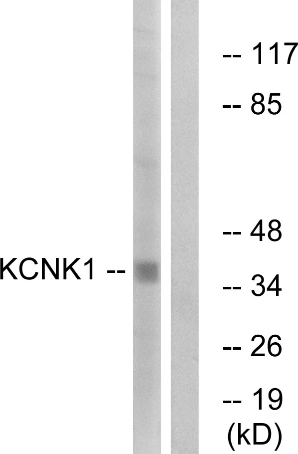 WB analysis of Jurkat cell lysates using GTX87344 KCNK1 antibody. The lane on the right is blocked with the synthesized peptide. WB analysis of Jurkat cell lysates using GTX87344 KCNK1 antibody. The lane on the right is blocked with the synthesized peptide.