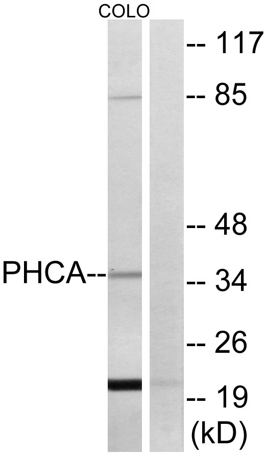 WB analysis of COLO cell lysates using GTX87351 ACER3 antibody. The lane on the right is blocked with the synthesized peptide.
