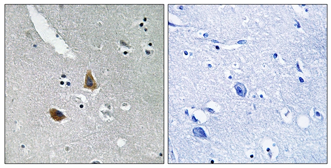 IHC-P analysis of human brain tissue using GTX87372 MRPL21 antibody. The picture on the right is blocked with the synthesized peptide. IHC-P analysis of human brain tissue using GTX87372 MRPL21 antibody. The picture on the right is blocked with the synthesized peptide.
