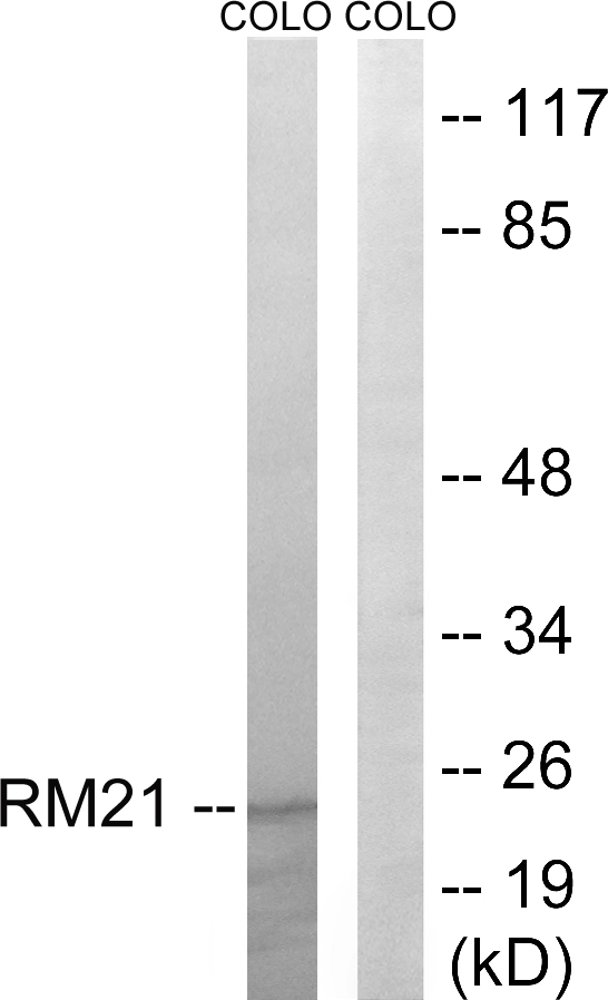 WB analysis of COLO cell lysates using GTX87372 MRPL21 antibody. The lane on the right is blocked with the synthesized peptide.