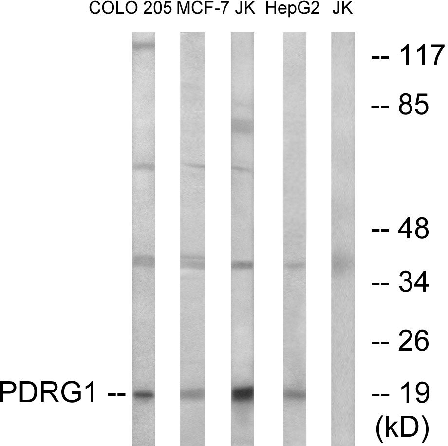 WB analysis of Jurkat, COLO, MCF-7, and HepG2 cell lysates using GTX87374 PDRG1 antibody. The lane on the right is blocked with the synthesized peptide. WB analysis of Jurkat, COLO, MCF-7, and HepG2 cell lysates using GTX87374 PDRG1 antibody. The lane on the right is blocked with the synthesized peptide.