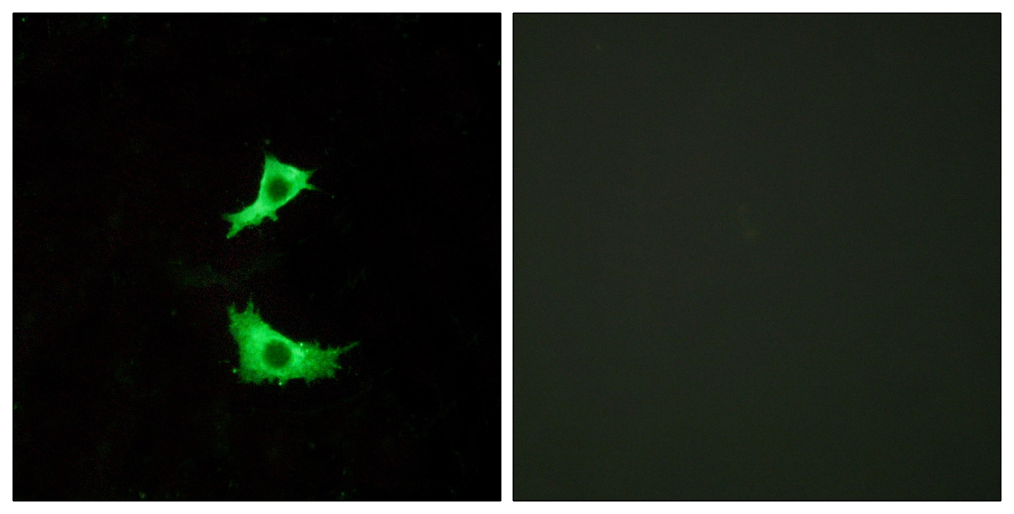 ICC/IF analysis of LOVO cells using GTX87383 FFAR3 antibody. The picture on the right is blocked with the synthesized peptide.