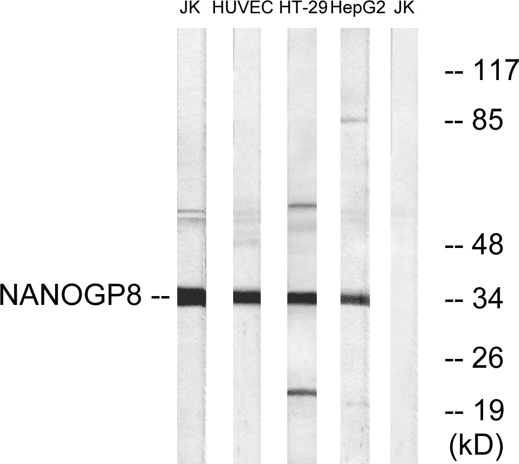 WB analysis of HUVEC, HT-29, HepG2, and Jurkat cell lysates using GTX87402 NANOGP8 antibody. The lane on the right is blocked with the synthesized peptide. WB analysis of HUVEC, HT-29, HepG2, and Jurkat cell lysates using GTX87402 NANOGP8 antibody. The lane on the right is blocked with the synthesized peptide.