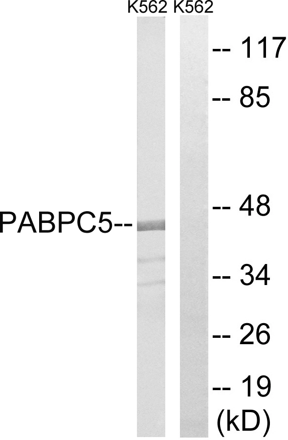WB analysis of K562 cell lysates using GTX87409 PABPC5 antibody. The lane on the right is blocked with the synthesized peptide. WB analysis of K562 cell lysates using GTX87409 PABPC5 antibody. The lane on the right is blocked with the synthesized peptide.