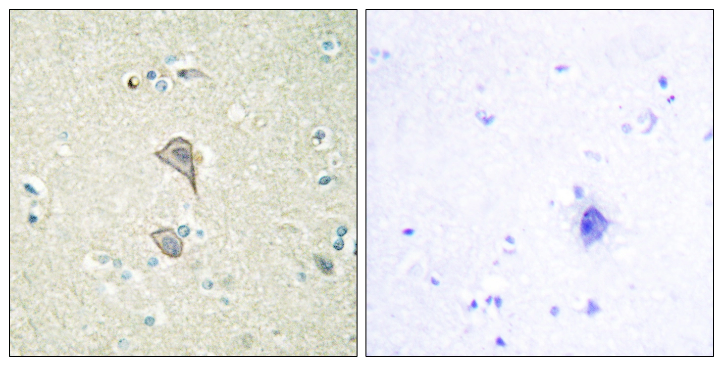 IHC-P analysis of human brain tissue using GTX87411 NKTR antibody. The picture on the right is blocked with the synthesized peptide.