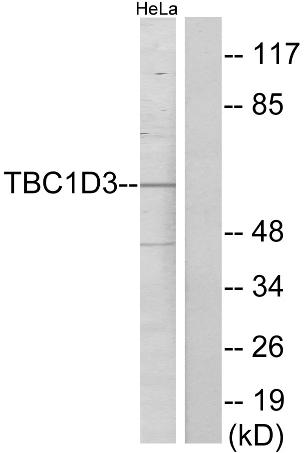 WB analysis of HeLa cell lysates using GTX87412 TBC1D3 antibody. The lane on the right is blocked with the synthesized peptide. WB analysis of HeLa cell lysates using GTX87412 TBC1D3 antibody. The lane on the right is blocked with the synthesized peptide.