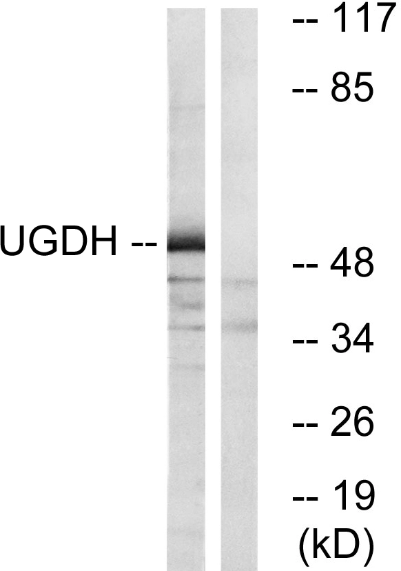 WB analysis of COLO cell lysates using GTX87421 UGDH antibody. The lane on the right is blocked with the synthesized peptide. WB analysis of COLO cell lysates using GTX87421 UGDH antibody. The lane on the right is blocked with the synthesized peptide.