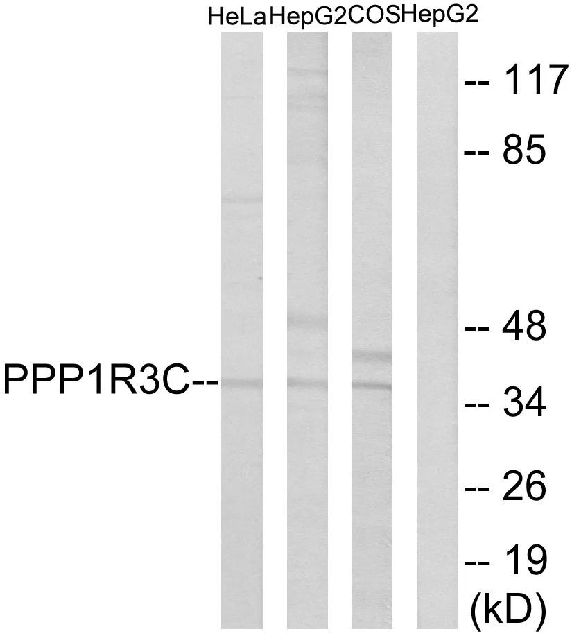WB analysis of HepG2,HeLa,and COS7 cell lysates using GTX87429 PPP1R3C antibody. The lane on the right is blocked with the synthesized peptide.