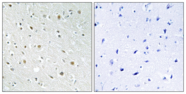 IHC-P analysis of human brain tissue using GTX87442 SSBP2 antibody. The picture on the right is blocked with the synthesized peptide. IHC-P analysis of human brain tissue using GTX87442 SSBP2 antibody. The picture on the right is blocked with the synthesized peptide.