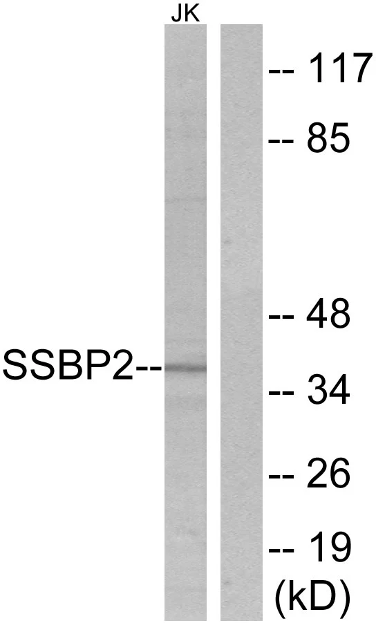 WB analysis of Jurkat cell lysates using GTX87442 SSBP2 antibody. The lane on the right is blocked with the synthesized peptide.