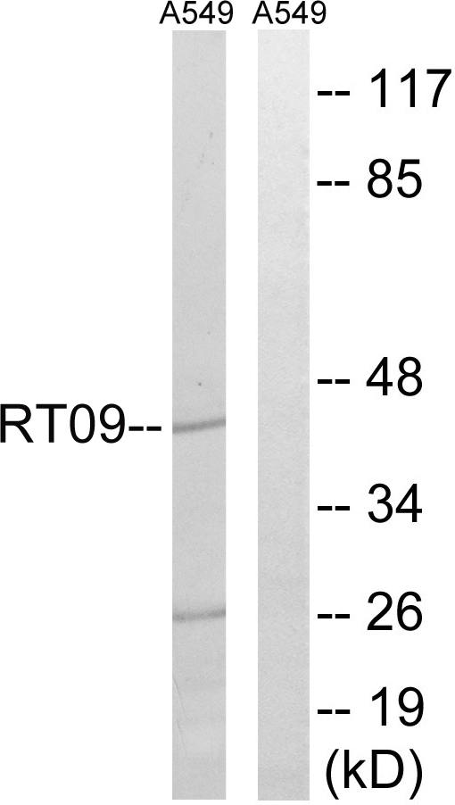 WB analysis of A549 cell lysates using GTX87450 MRPS9 antibody. The lane on the right is blocked with the synthesized peptide. WB analysis of A549 cell lysates using GTX87450 MRPS9 antibody. The lane on the right is blocked with the synthesized peptide.