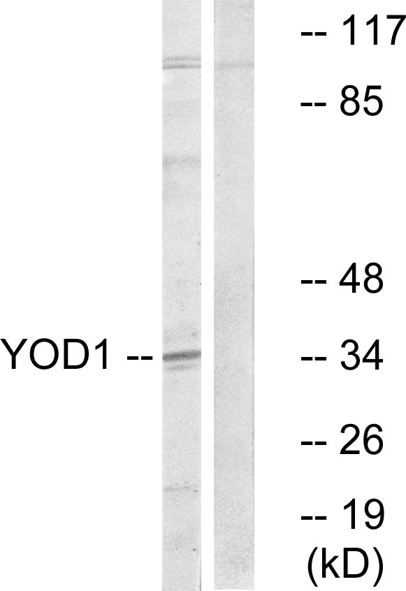 WB analysis of COLO cell lysates using GTX87455 YOD1 antibody. The lane on the right is blocked with the synthesized peptide. WB analysis of COLO cell lysates using GTX87455 YOD1 antibody. The lane on the right is blocked with the synthesized peptide.