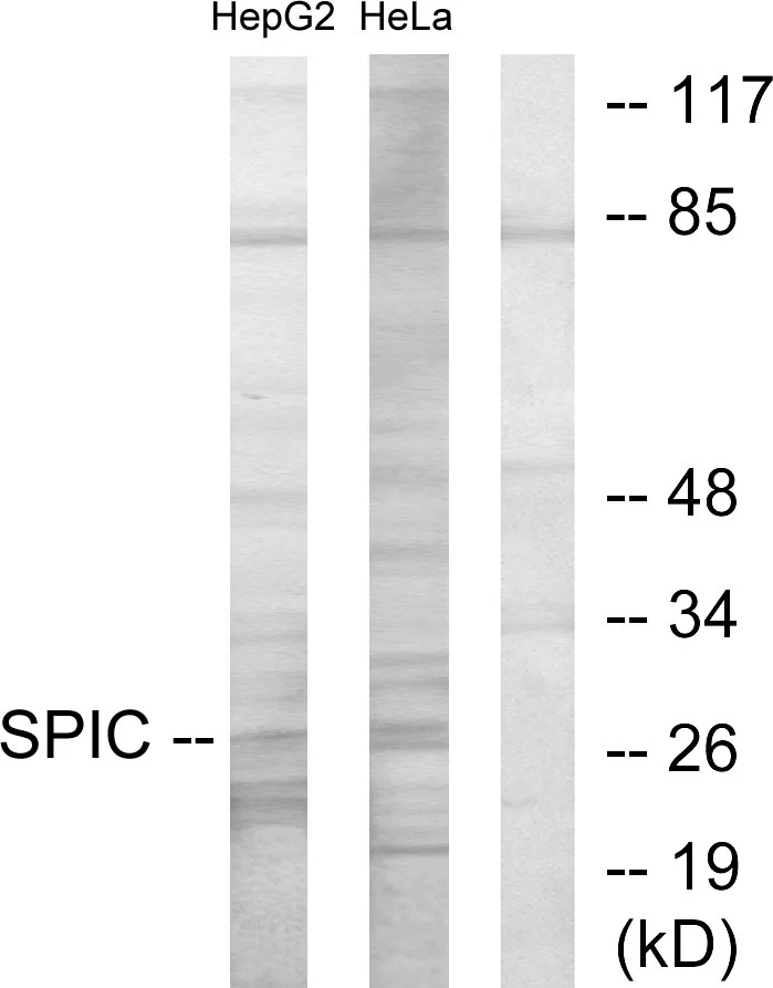 WB analysis of HepG2 and HeLa cell lysates using GTX87463 Spi-C antibody. The lane on the right is blocked with the synthesized peptide.