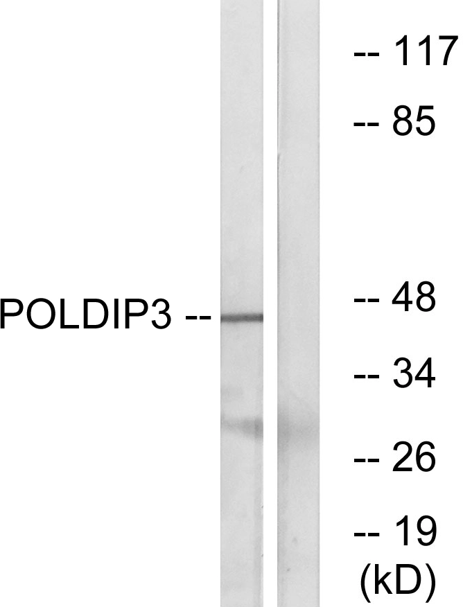 WB analysis of RAW264.7 cell lysates using GTX87468 POLDIP3 antibody. The lane on the right is blocked with the synthesized peptide. WB analysis of RAW264.7 cell lysates using GTX87468 POLDIP3 antibody. The lane on the right is blocked with the synthesized peptide.
