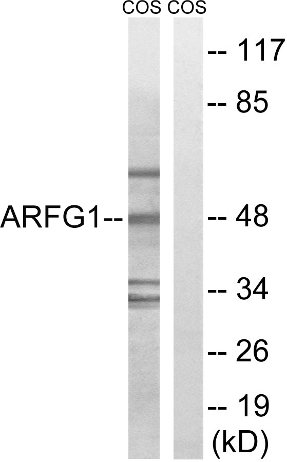 WB analysis of COS7 cell lysates using GTX87479 ARFGAP1 antibody. The lane on the right is blocked with the synthesized peptide.