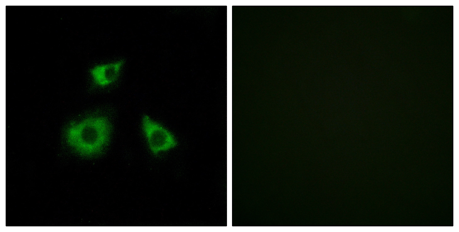 ICC/IF analysis of HUVEC cells using GTX87484 MRPL52 antibody. The picture on the right is blocked with the synthesized peptide. ICC/IF analysis of HUVEC cells using GTX87484 MRPL52 antibody. The picture on the right is blocked with the synthesized peptide.
