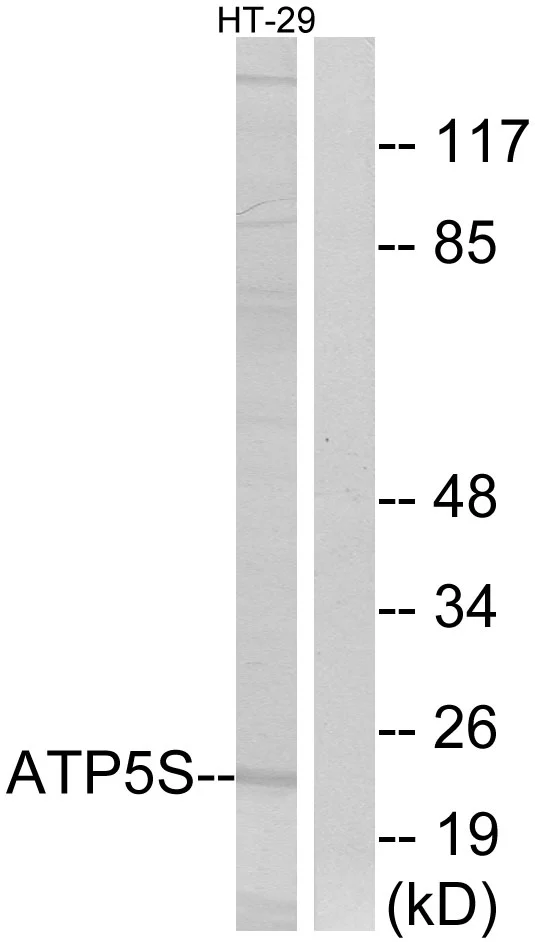 WB analysis of HT-29 cell lysates using GTX87485 ATP5S antibody. The lane on the right is blocked with the synthesized peptide. WB analysis of HT-29 cell lysates using GTX87485 ATP5S antibody. The lane on the right is blocked with the synthesized peptide.
