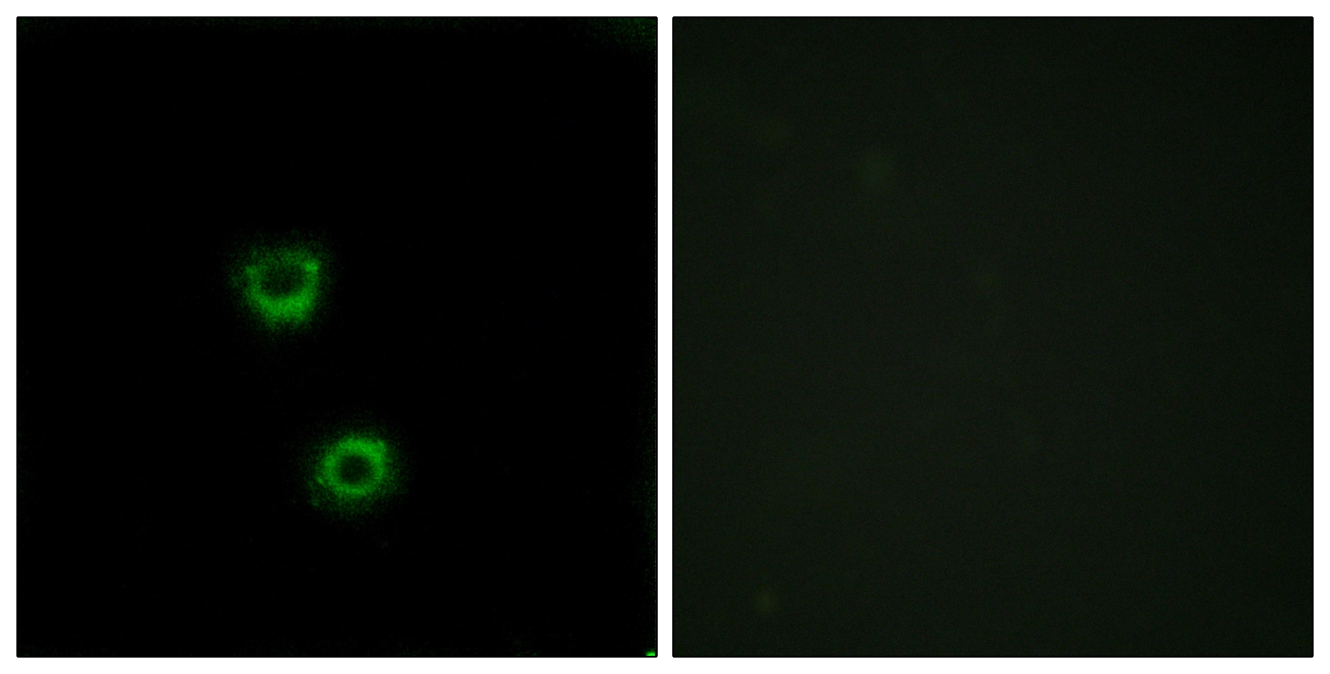 ICC/IF analysis of MCF7 cells using GTX87491 TMEM30C antibody. The picture on the right is blocked with the synthesized peptide.