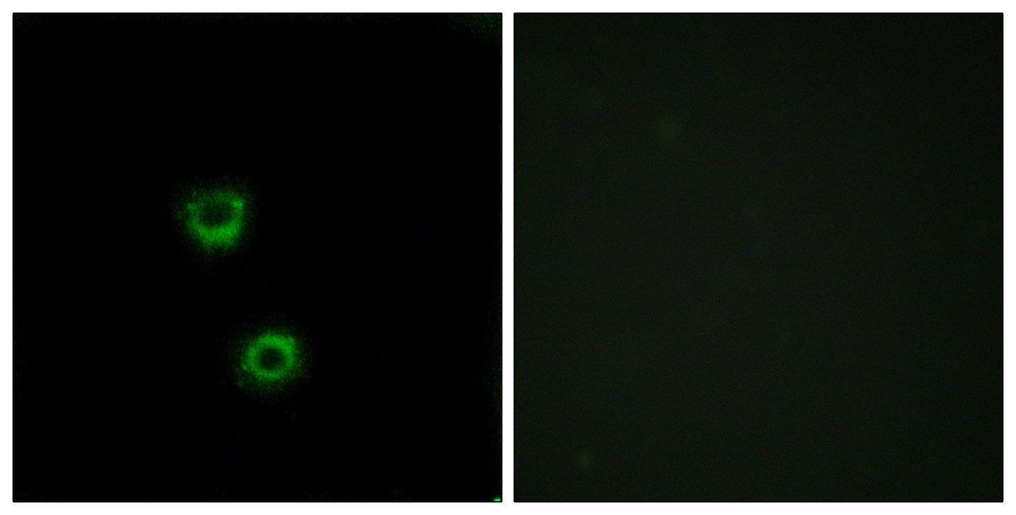 ICC/IF analysis of MCF7 cells using GTX87491 TMEM30C antibody. The picture on the right is blocked with the synthesized peptide. ICC/IF analysis of MCF7 cells using GTX87491 TMEM30C antibody. The picture on the right is blocked with the synthesized peptide.