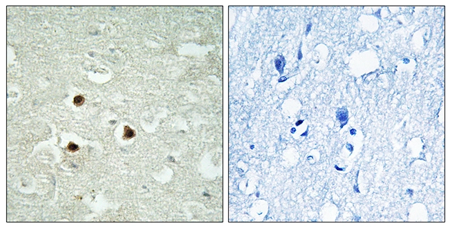 IHC-P analysis of human brain tissue using GTX87492 RAB3IP antibody. The picture on the right is blocked with the synthesized peptide. IHC-P analysis of human brain tissue using GTX87492 RAB3IP antibody. The picture on the right is blocked with the synthesized peptide.