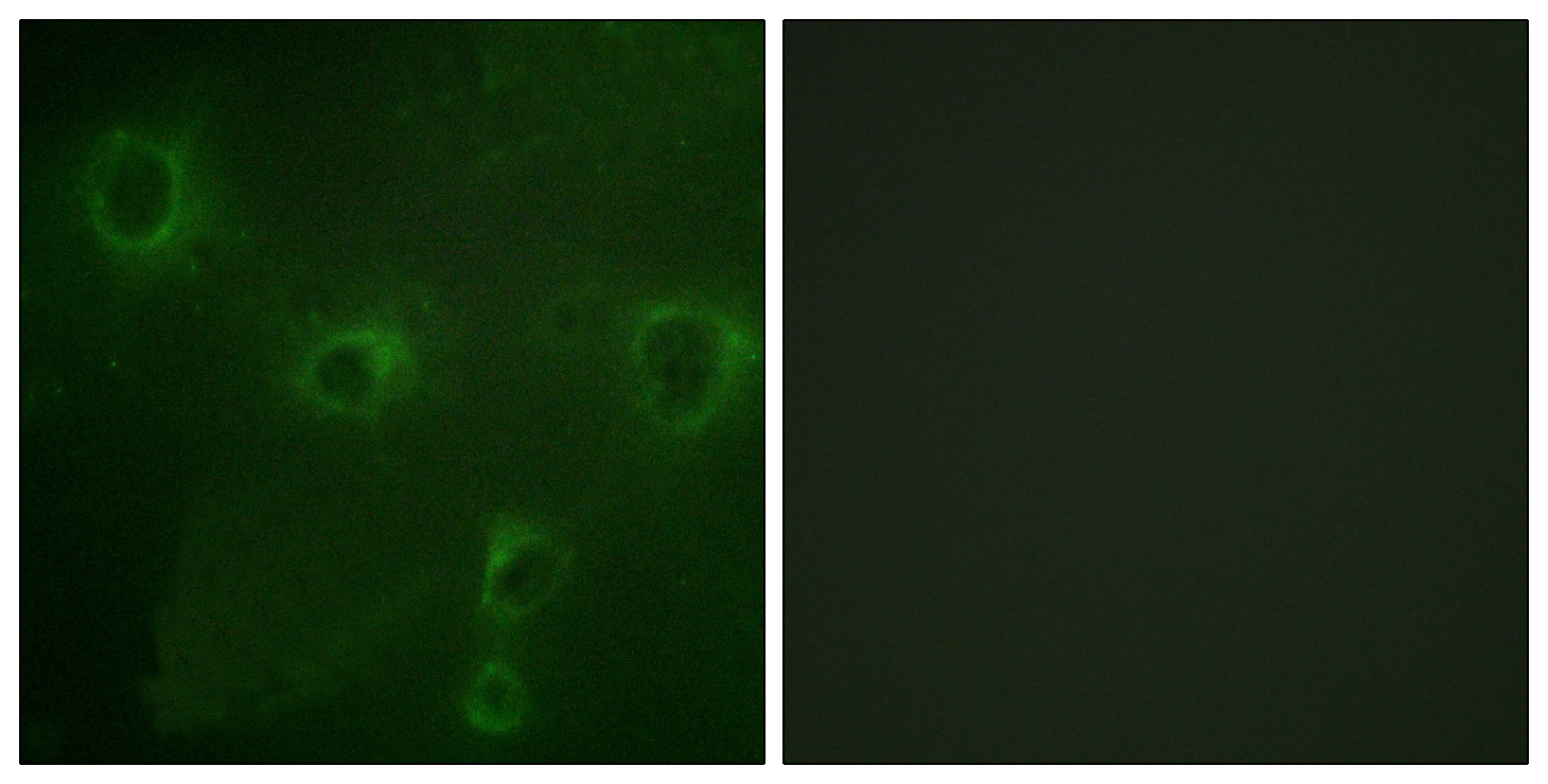ICC/IF analysis of COS7 cells using GTX87498 Kv2.1 antibody. The picture on the right is blocked with the synthesized peptide. ICC/IF analysis of COS7 cells using GTX87498 Kv2.1 antibody. The picture on the right is blocked with the synthesized peptide.