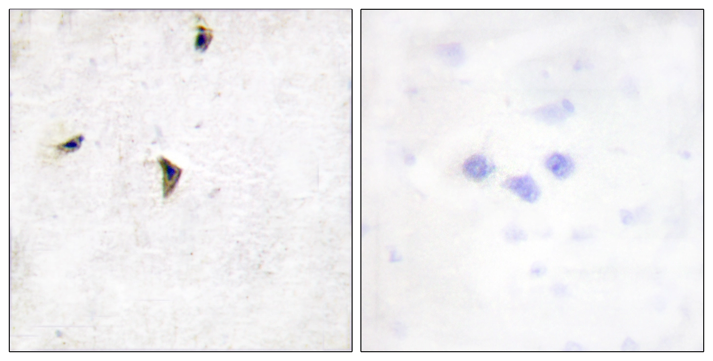 IHC-P analysis of human brain tissue using GTX87498 Kv2.1 antibody. The picture on the right is blocked with the synthesized peptide.
