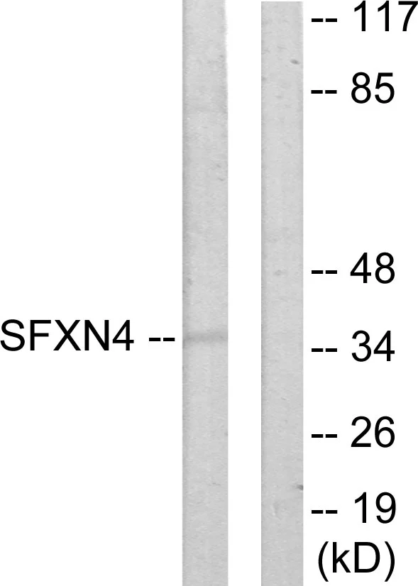 WB analysis of HUVEC cell lysates using GTX87501 SFXN4 antibody. The lane on the right is blocked with the synthesized peptide. WB analysis of HUVEC cell lysates using GTX87501 SFXN4 antibody. The lane on the right is blocked with the synthesized peptide.