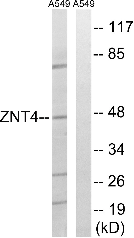 WB analysis of A549 cell lysates using GTX87502 SLC30A4 antibody. The lane on the right is blocked with the synthesized peptide.