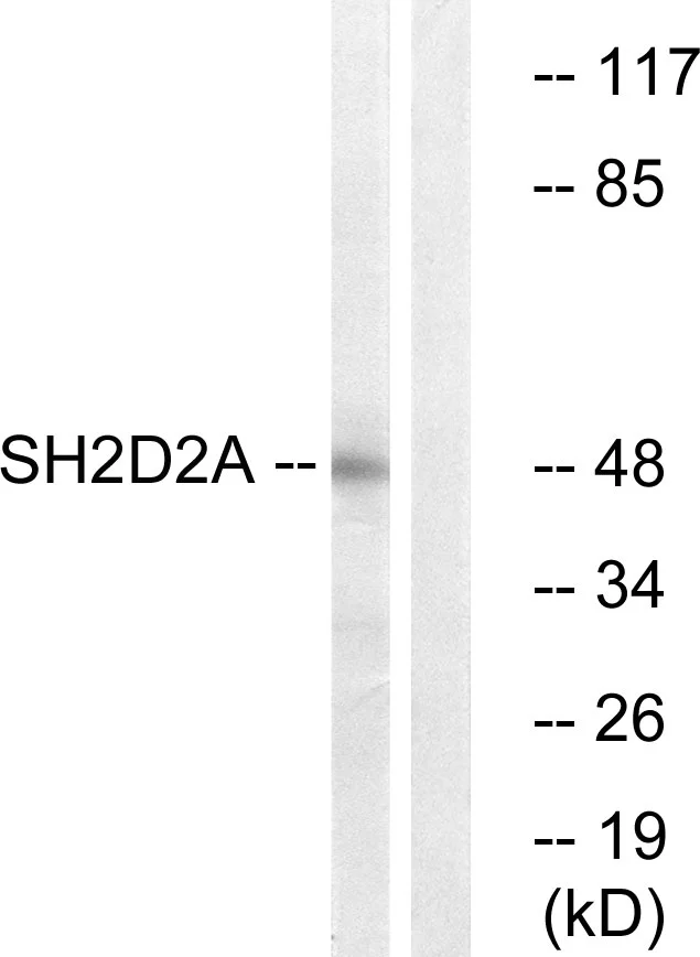 WB analysis of HepG2 cell lysates using GTX87514 SH2D2A antibody. The lane on the right is blocked with the synthesized peptide. WB analysis of HepG2 cell lysates using GTX87514 SH2D2A antibody. The lane on the right is blocked with the synthesized peptide.
