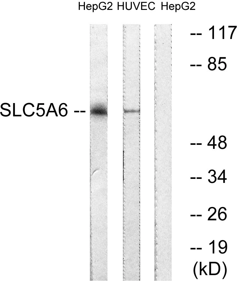 WB analysis of HepG2 and HUVEC cell lysates using GTX87516 SLC5A6 antibody. The lane on the right is blocked with the synthesized peptide.