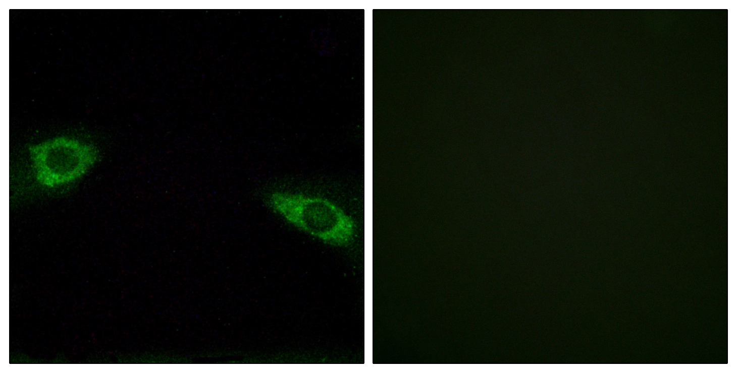 ICC/IF analysis of HUVEC cells using GTX87517 RPS4Y1 antibody. The picture on the right is blocked with the synthesized peptide. ICC/IF analysis of HUVEC cells using GTX87517 RPS4Y1 antibody. The picture on the right is blocked with the synthesized peptide.