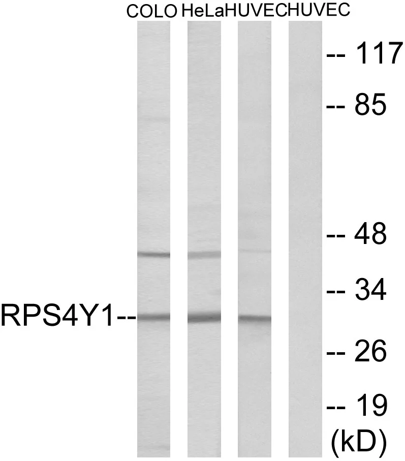 WB analysis of HUVEC, HeLa, and COLO cell lysates using GTX87517 RPS4Y1 antibody. The lane on the right is blocked with the synthesized peptide.