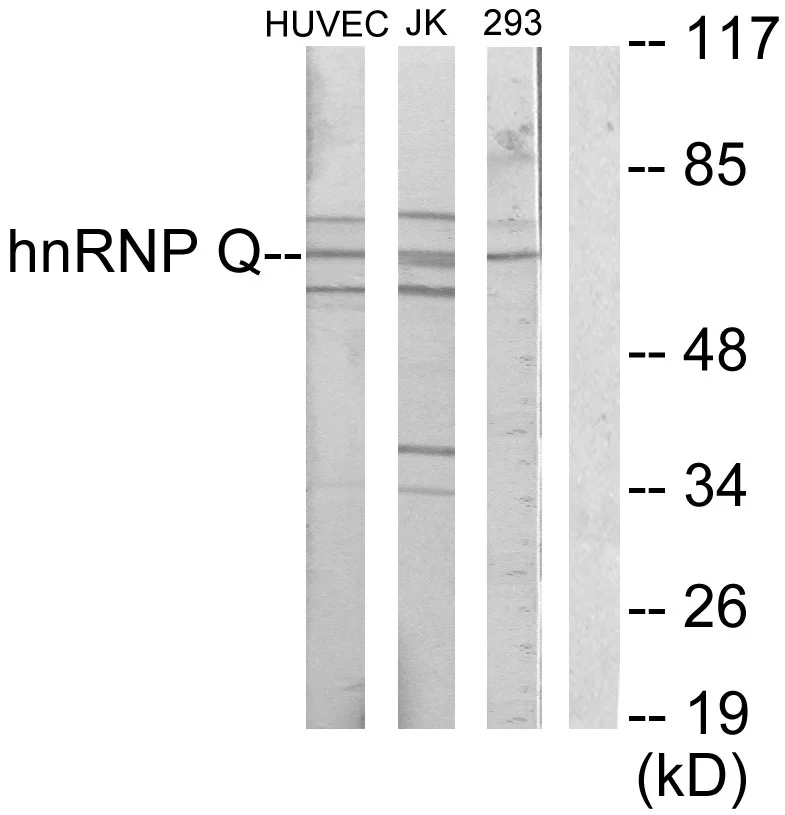 WB analysis of Jurkat, HUVEC, and 293 cell lysates using GTX87520 hnRNP Q antibody. The lane on the right is blocked with the synthesized peptide.