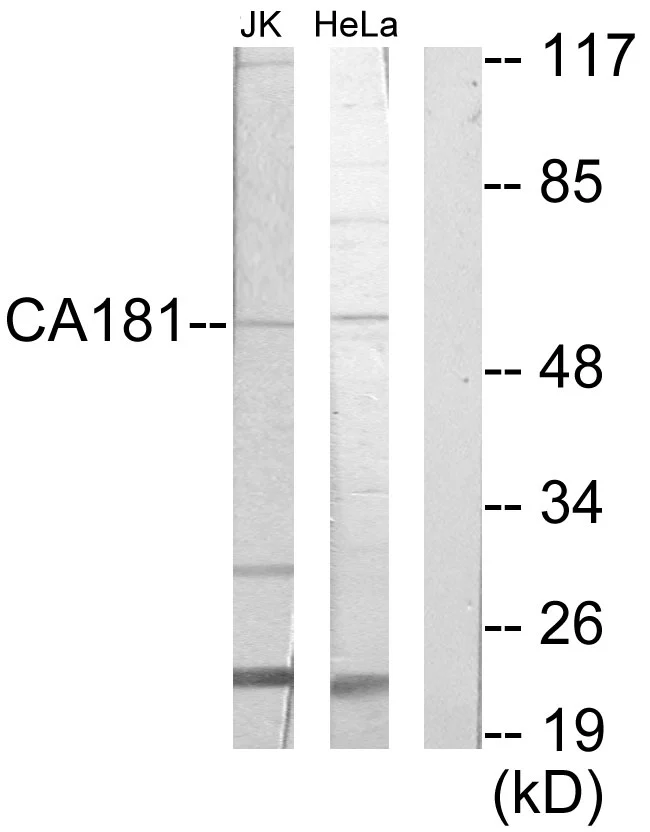 WB analysis of Jurkat and HeLa cell lysates using GTX87536 ZNHIT6 antibody. The lane on the right is blocked with the synthesized peptide. WB analysis of Jurkat and HeLa cell lysates using GTX87536 ZNHIT6 antibody. The lane on the right is blocked with the synthesized peptide.