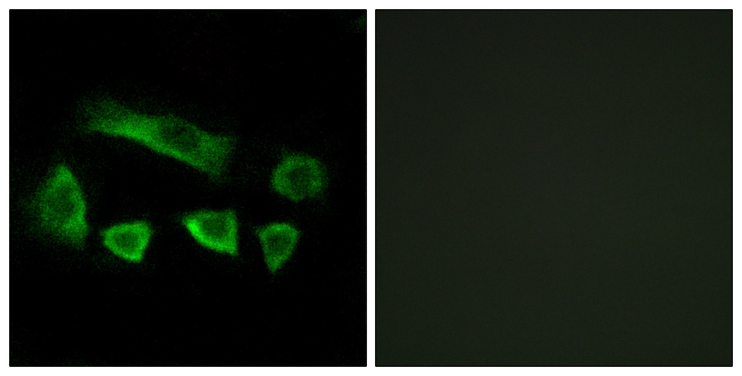 ICC/IF analysis of A549 cells using GTX87540 NT5C1B antibody. The picture on the right is blocked with the synthesized peptide. ICC/IF analysis of A549 cells using GTX87540 NT5C1B antibody. The picture on the right is blocked with the synthesized peptide.