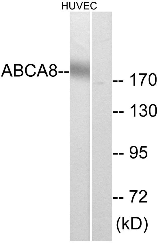 WB analysis of HUVEC cell lysates using GTX87546 ABCA8 antibody. The lane on the right is blocked with the synthesized peptide. WB analysis of HUVEC cell lysates using GTX87546 ABCA8 antibody. The lane on the right is blocked with the synthesized peptide.