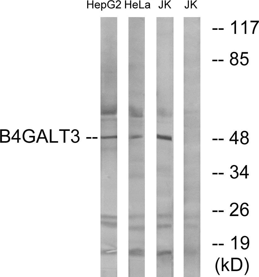 WB analysis of Jurkat, HeLa, and HepG2 cell lysates using GTX87547 B4GALT3 antibody. The lane on the right is blocked with the synthesized peptide.
