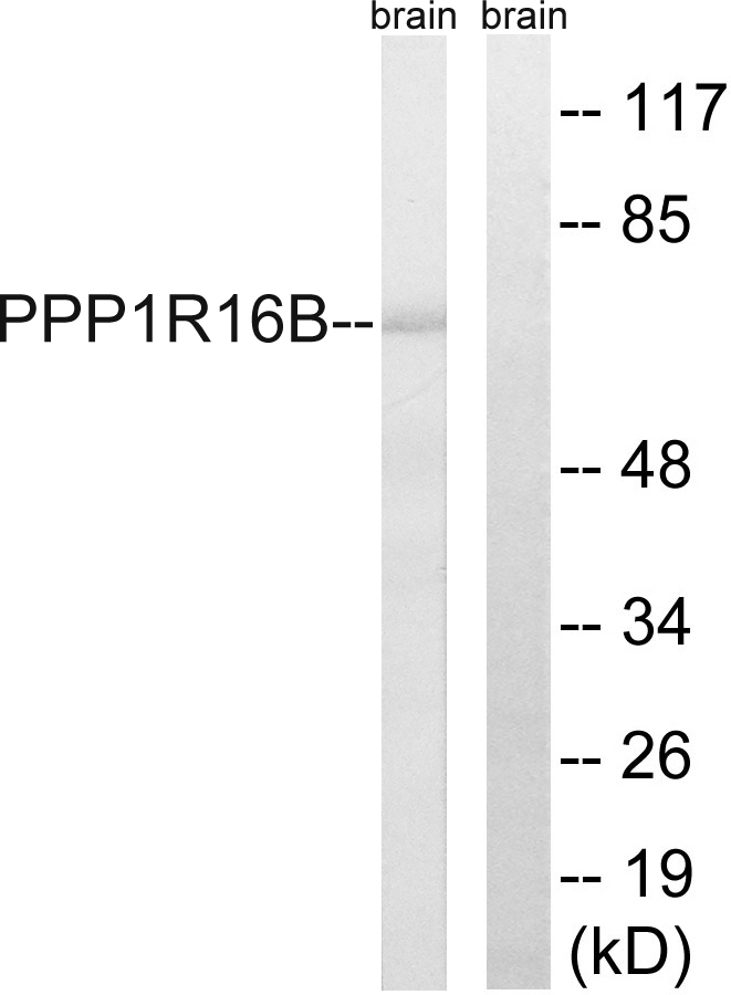 WB analysis of mouse brain lysates using GTX87549 PPP1R16B antibody. The lane on the right is blocked with the synthesized peptide. WB analysis of mouse brain lysates using GTX87549 PPP1R16B antibody. The lane on the right is blocked with the synthesized peptide.
