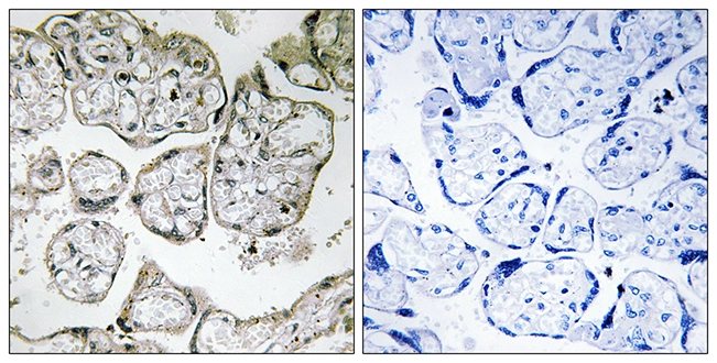IHC-P analysis of human placenta tissue using GTX87553 ME2 antibody. The picture on the right is blocked with the synthesized peptide. IHC-P analysis of human placenta tissue using GTX87553 ME2 antibody. The picture on the right is blocked with the synthesized peptide.