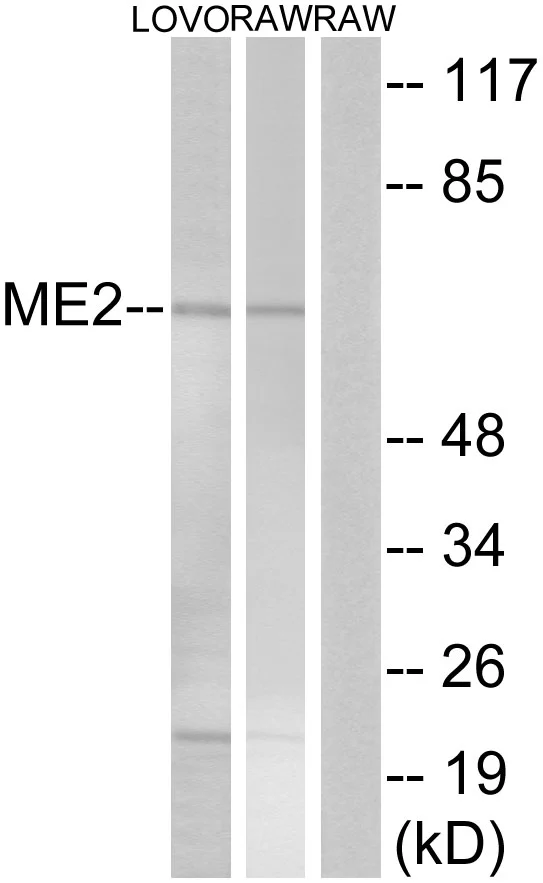 WB analysis of RAW264.7 and LOVO cell lysates using GTX87553 ME2 antibody. The lane on the right is blocked with the synthesized peptide.