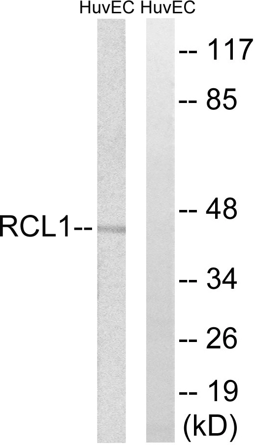 WB analysis of HUVEC cell lysates using GTX87566 RCL1 antibody. The lane on the right is blocked with the synthesized peptide. WB analysis of HUVEC cell lysates using GTX87566 RCL1 antibody. The lane on the right is blocked with the synthesized peptide.